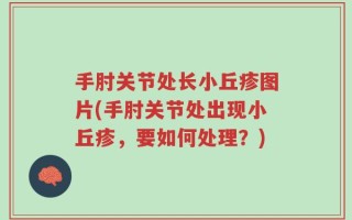 手肘关节处长小丘疹图片(手肘关节处出现小丘疹，要如何处理？)