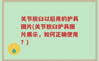 关节脱臼以后用的护具图片(关节脱臼护具图片展示，如何正确使用？)
