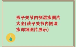 孩子关节内侧湿疹图片大全(孩子关节内侧湿疹详细图片展示)