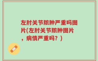 左肘关节脓肿严重吗图片(左肘关节脓肿图片，病情严重吗？)