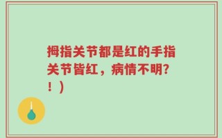 拇指关节都是红的手指关节皆红，病情不明？！)