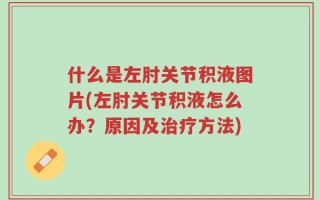 什么是左肘关节积液图片(左肘关节积液怎么办？原因及治疗方法)