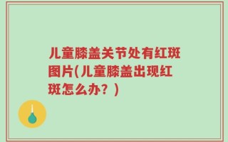 儿童膝盖关节处有红斑图片(儿童膝盖出现红斑怎么办？)