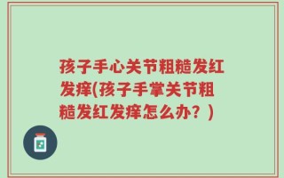 孩子手心关节粗糙发红发痒(孩子手掌关节粗糙发红发痒怎么办？)