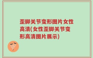 歪脚关节变形图片女性高清(女性歪脚关节变形高清图片展示)
