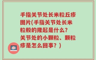 手指关节处长米粒丘疹图片(手指关节处长米粒般的隆起是什么？ 关节处的小颗粒、颗粒疹是怎么回事？)