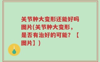 关节肿大变形还能好吗图片(关节肿大变形，是否有治好的可能？【图片】)