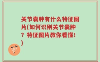 关节囊肿有什么特征图片(如何识别关节囊肿？特征图片教你看懂！)