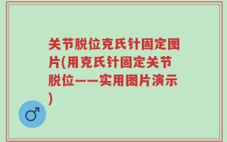 关节脱位克氏针固定图片(用克氏针固定关节脱位——实用图片演示)