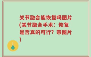 关节融合能恢复吗图片(关节融合手术：恢复是否真的可行？带图片)