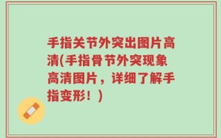 手指关节外突出图片高清(手指骨节外突现象高清图片，详细了解手指变形！)