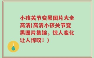 小孩关节变黑图片大全高清(高清小孩关节变黑图片集锦，惊人变化让人惊叹！)