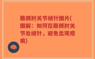 胳膊肘关节缝针图片(图解：如何在胳膊肘关节处缝针，避免出现疤痕)