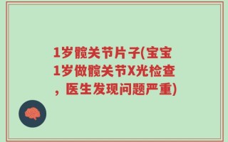 1岁髋关节片子(宝宝1岁做髋关节X光检查，医生发现问题严重)