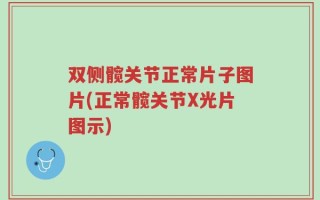 双侧髋关节正常片子图片(正常髋关节X光片图示)