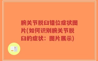 腕关节脱臼错位症状图片(如何识别腕关节脱臼的症状：图片展示)
