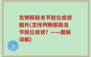 左侧髌股关节脱位症状图片(怎样判断髌股关节脱位症状？——图解详解)