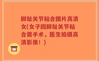 脚趾关节粘合图片高清女(女子因脚趾关节粘合需手术，医生拍摄高清影像！)