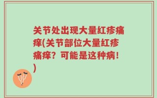 关节处出现大量红疹痛痒(关节部位大量红疹痛痒？可能是这种病！)