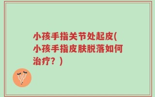 小孩手指关节处起皮(小孩手指皮肤脱落如何治疗？)