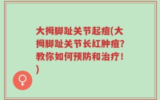 大拇脚趾关节起痘(大拇脚趾关节长红肿痘？教你如何预防和治疗！)