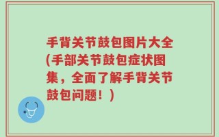 手背关节鼓包图片大全(手部关节鼓包症状图集，全面了解手背关节鼓包问题！)