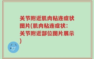 关节附近肌肉粘连症状图片(肌肉粘连症状：关节附近部位图片展示)