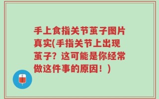 手上食指关节茧子图片真实(手指关节上出现茧子？这可能是你经常做这件事的原因！)