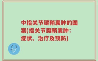 中指关节腱鞘囊肿的图案(指关节腱鞘囊肿：症状、治疗及预防)