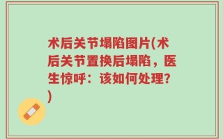 术后关节塌陷图片(术后关节置换后塌陷，医生惊呼：该如何处理？)