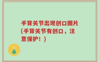 手背关节出现创口图片(手背关节有创口，注意保护！)