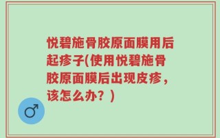 悦碧施骨胶原面膜用后起疹子(使用悦碧施骨胶原面膜后出现皮疹，该怎么办？)