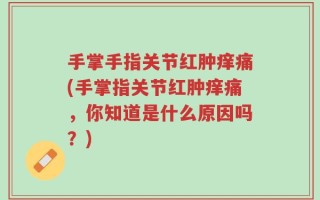 手掌手指关节红肿痒痛(手掌指关节红肿痒痛，你知道是什么原因吗？)