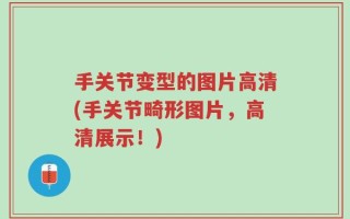 手关节变型的图片高清(手关节畸形图片，高清展示！)