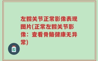 左髋关节正常影像表现图片(正常左髋关节影像：查看骨骼健康无异常)