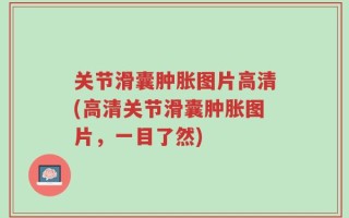 关节滑囊肿胀图片高清(高清关节滑囊肿胀图片，一目了然)
