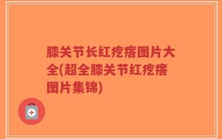 膝关节长红疙瘩图片大全(超全膝关节红疙瘩图片集锦)
