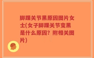 脚踝关节黑原因图片女士(女子脚踝关节变黑是什么原因？附相关图片)