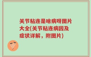 关节粘连是啥病呀图片大全(关节粘连病因及症状详解，附图片)