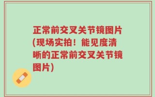 正常前交叉关节镜图片(现场实拍！能见度清晰的正常前交叉关节镜图片)
