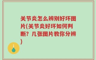关节炎怎么辨别好坏图片(关节炎好坏如何判断？几张图片教你分辨)