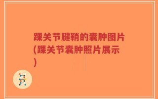 踝关节腱鞘的囊肿图片(踝关节囊肿照片展示)