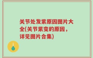 关节处发紫原因图片大全(关节紫变的原因，详见图片合集)