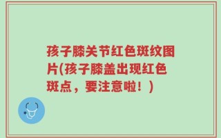 孩子膝关节红色斑纹图片(孩子膝盖出现红色斑点，要注意啦！)