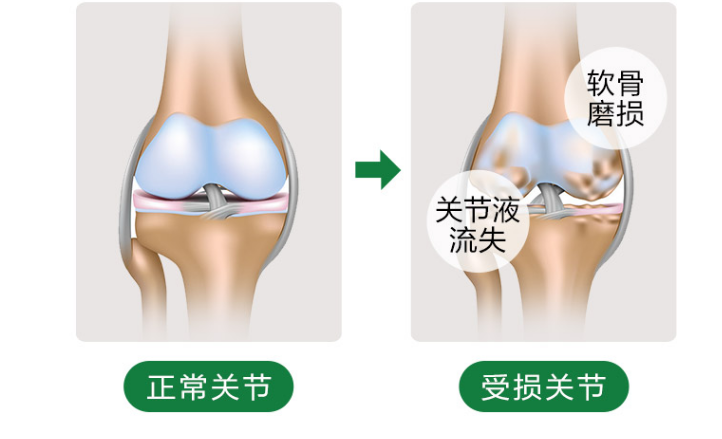 氨糖软骨素的作用能补钙吗?具体能够起到哪些作用?-第1张图片-超越 氨糖软骨素的作用能补钙吗?具体能够起到哪些作用?-第1张图片-超越