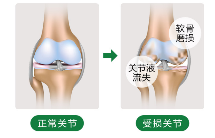 氨糖软骨素的作用和普通钙片有哪些区别?-第1张图片-超越 氨糖软骨素的作用和普通钙片有哪些区别?-第1张图片-超越