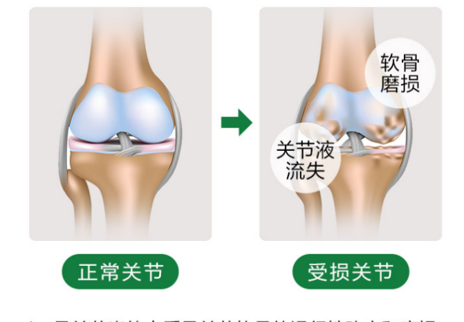 氨糖的作用能保护膝关节吗？-第1张图片-超越