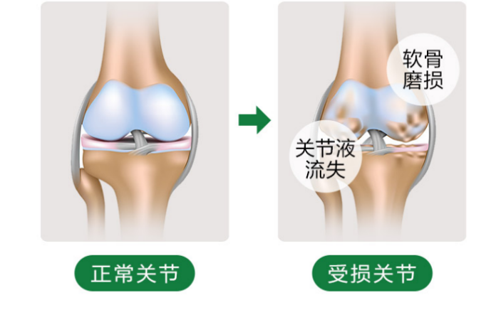 氨基葡萄糖是什么？还和葡萄糖有没有区别？-第1张图片-超越