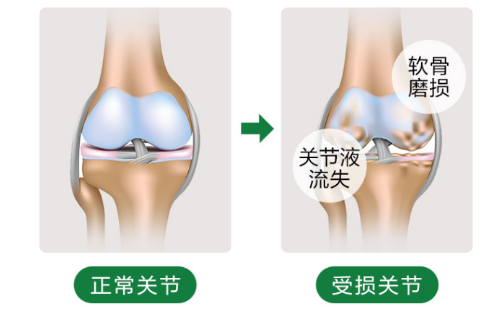 氨糖的作用还是钙的作用适合养护关节？-第1张图片-超越
