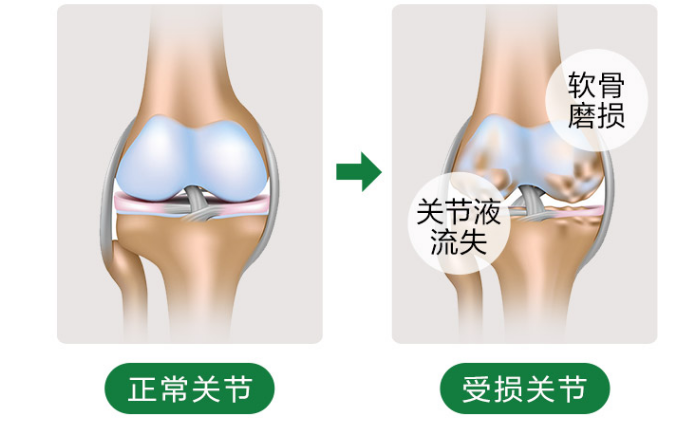 氨糖软骨素是什么？能够起到哪些作用？-第1张图片-超越